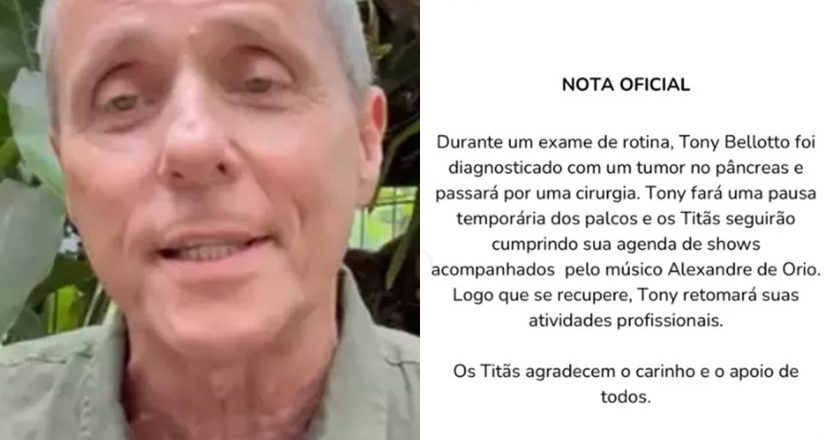 Tony Bellotto compartilha sua luta contra o câncer e revela: “Não posso afirmar que estou curado