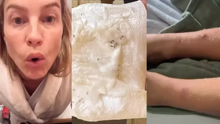Piovani revela diálogo com ex de Scooby e denuncia que filha contraiu piolhos no Brasil: “É hora de crescer!